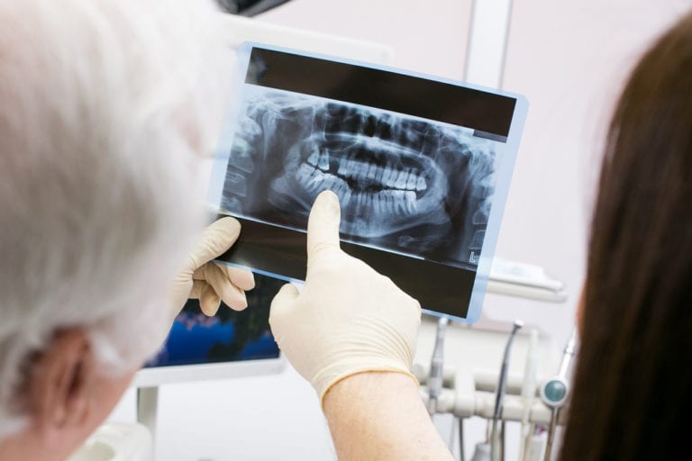 Dental X-Rays visual exam