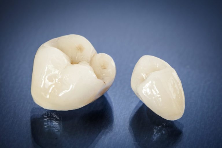 Procelain crown caps