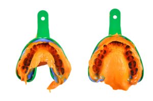 dental impression