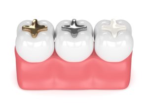 composite fillings vs. amalgam fillings
