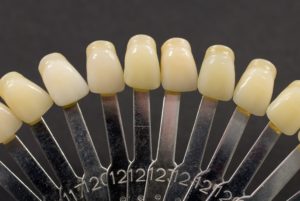 veneer shade guide with various colored teeth