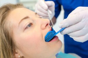 woman having a dental impression taken of her top teeth by biting into a plastic tray