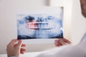 Hands holding a dental xray