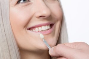 veneers