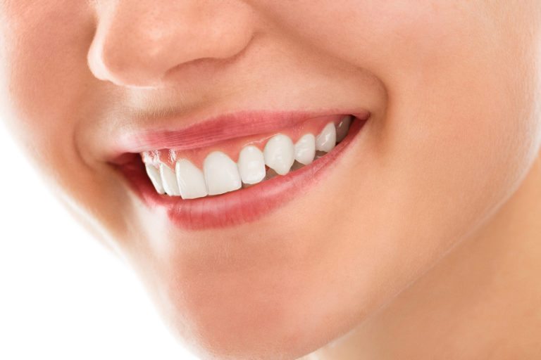 white smile