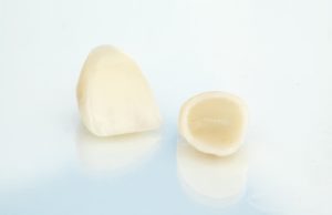Porcelain crown on white background