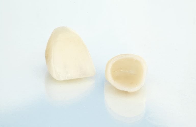 Porcelain crown on white background