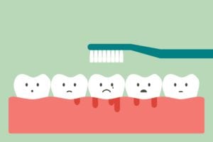 Cartoon of sad teeth sitting on gums with gingivitis