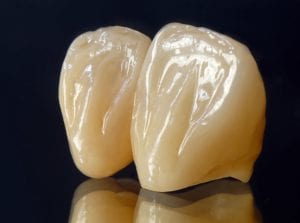 Dental crowns on a black background