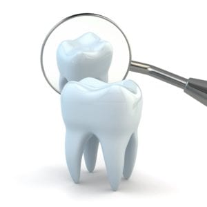 Model tooth with a dental mirror on a white background