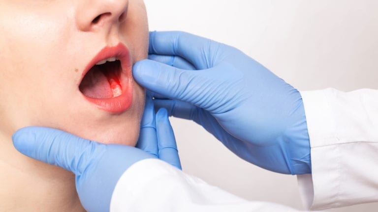 Dentist examining a child's mouth