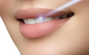 Woman with clean teeth